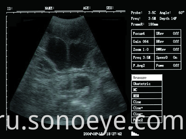 v5 pet ultrasound